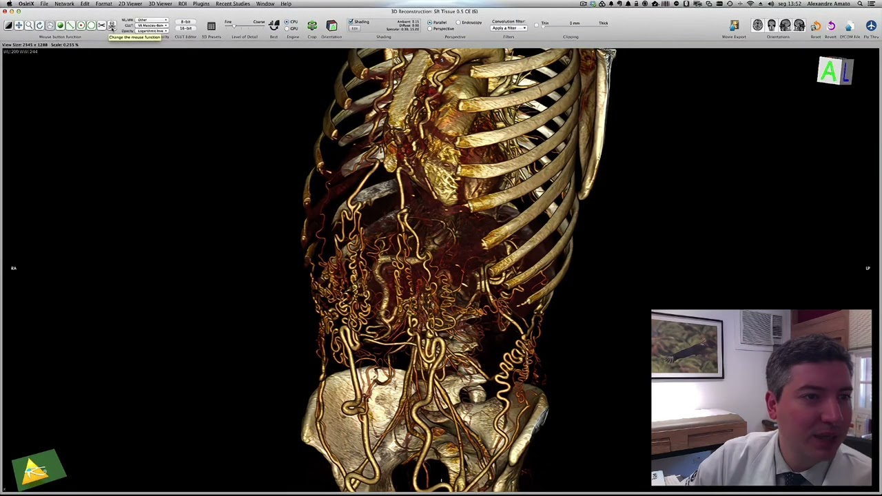 3D Volume Rendering - Básico | Curso OsiriX