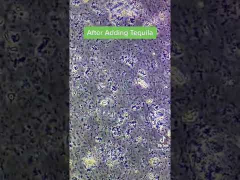 Bacteria VS Tequila alcohol under the microscope!