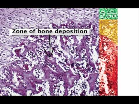Chapter 7   Bone Elongation