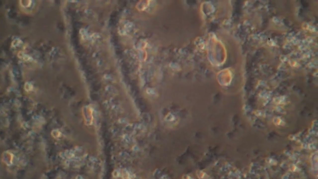 Yogurt Under the Microscope