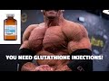You NEED Injectable Glutathione for Health and Recovery