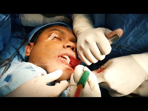 Maxillofacial Complete Face Makeover Surgery