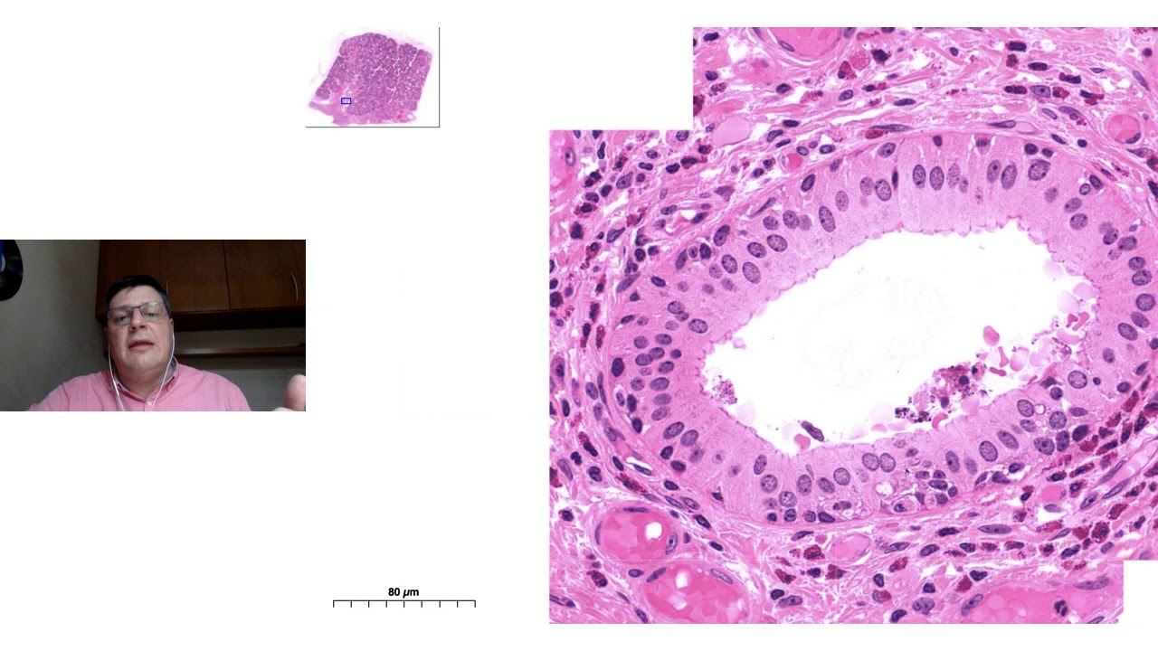Classificação histológica das glândulas