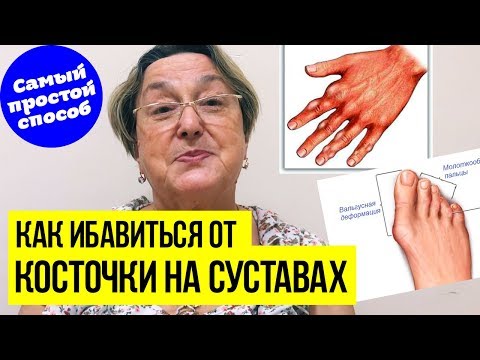 Узи коленного сустава в полтаве цена Кровати для лечения позвоночника видео
