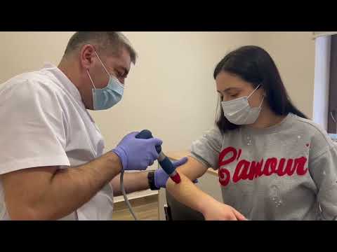 Ударно-хвильова терапія на апараті STORZ MEDICAL MASTERPULS MP100 (Швейцарія)