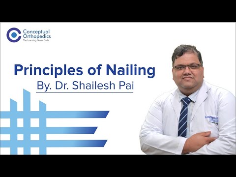 Principles of Nailing by Dr. Shailesh Pai @ConceptualOrthopedics
