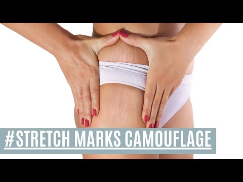Stretch Marks Camouflage | Suki Su Permanent Natural Makeup