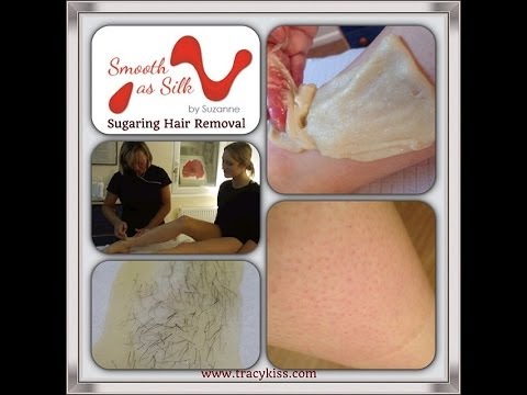 Sugaring Leg Hair Removal With Tracy Kiss