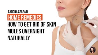 Home Remedies How To Get Rid Of Skin Moles Overnight Naturally