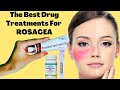 The Best Drug Treatments For ROSACEA |  Rosacea Prevention Tips