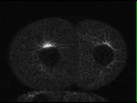 Still image from the Video of Spindle assembly in a &lt;em&gt;C. elegans&lt;/em&gt; embryo YouTube video