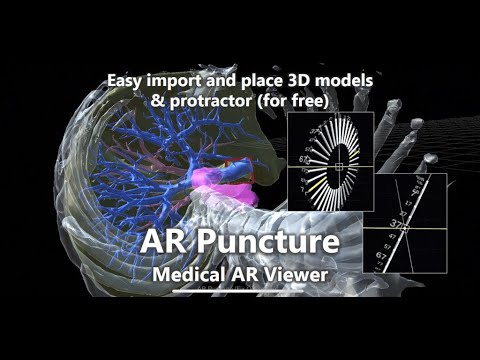 AR Puncture: Medical AR Viewer