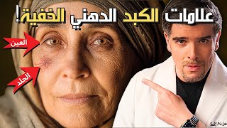 7 علامات صادمة عندك كبد دهني و اقوى علاج طبيعي (بشهرين!)