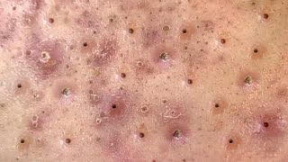 Satisfying and Relaxation with SURI NGUYEN Beauty Spa Video #466