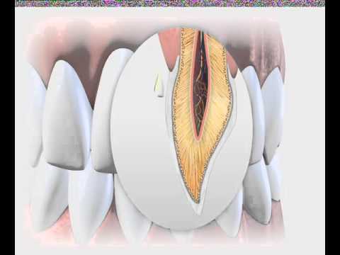 Ngăn chớm sâu răng , tẩy bay đốm trắng !