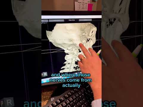 Tinnitus: Ringing in the Ears