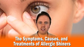 The Symptoms, Causes, and Treatments of Allergic Shiners