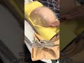 How We Flip A Breech Baby Shorts Obgyn Breech Simulator