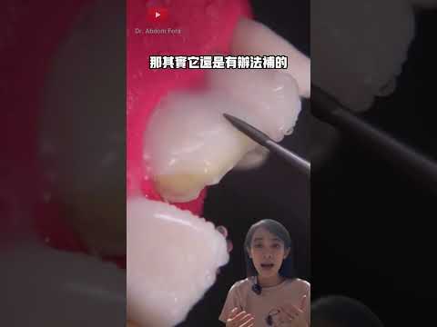 門牙疏