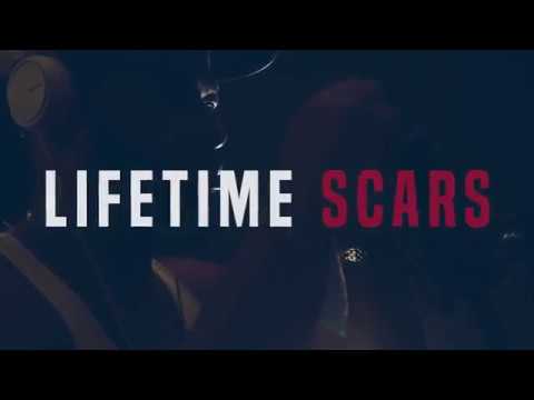 Sawed Off - Lifetime Scars (Official Video)