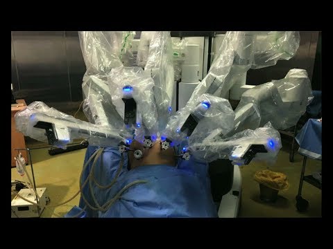 Robotic Total Abdominal Hysterectomy with Pelvic LND CA Cervix