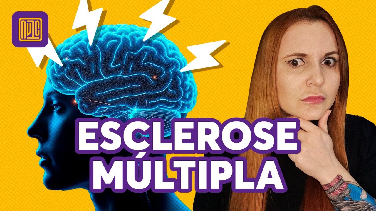 Quais são os primeiros sinais da Esclerose Múltipla?