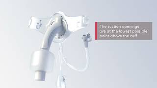 Product video: Tracoe Twist Plus Spare Inner Cannula (IC)