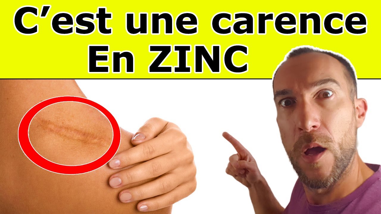 5 SIGNES qui montrent que vous manquez de ZINC