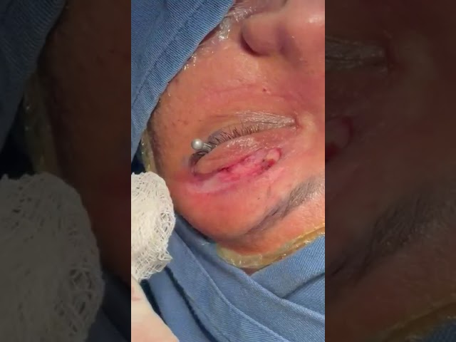 Vídeo