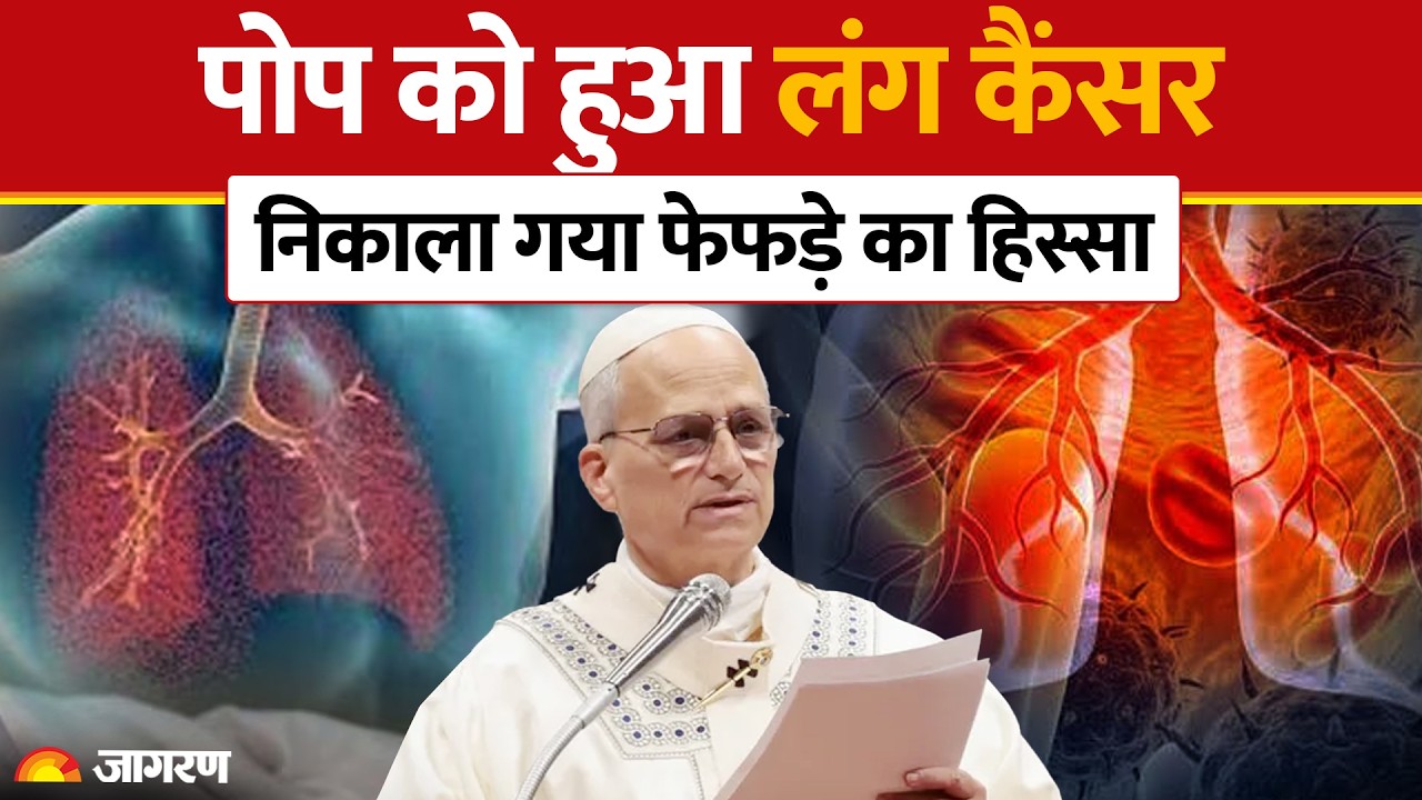 Pope Leo XIV Lung Cancer Surgery: पोप को हुआ लंग कैंसर | Rome Gemelli Hospital | Catholic Church