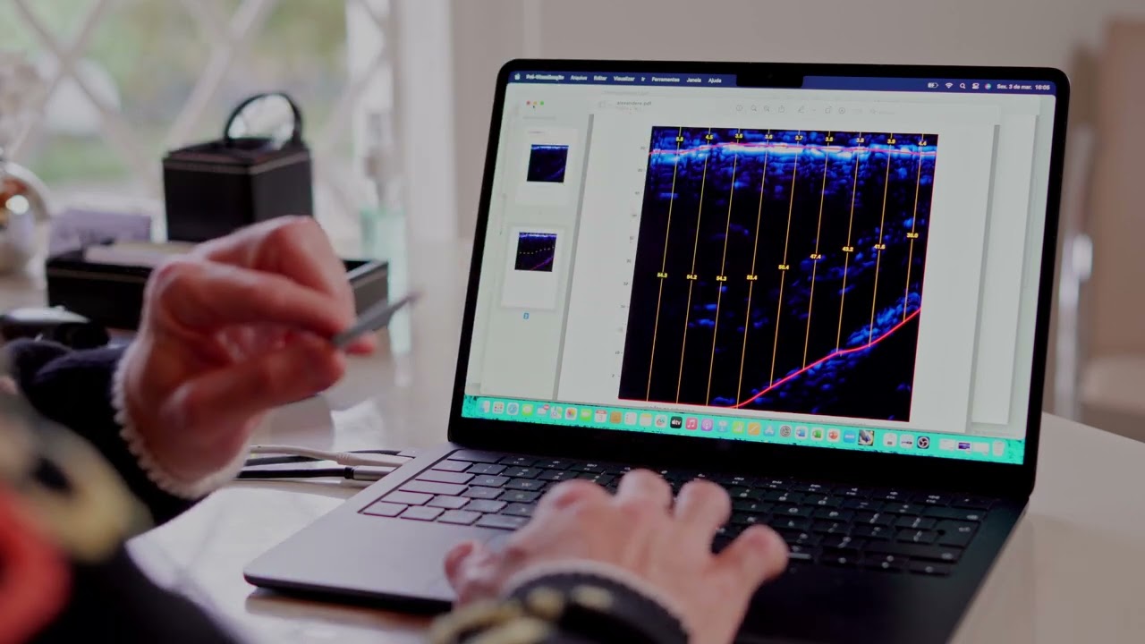 Vinícius Basso Preti-8