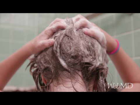 How to Remove Head Lice | WebMD