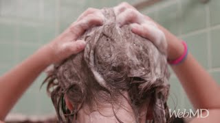 How to Remove Head Lice | WebMD