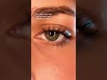 Does anyone else have central heterochromia?
