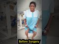 Successful Knee Replacement || Before Knee Replacement || Knee Replacement After 1 Month