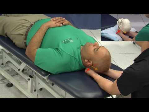 CV4-Compression of the 4th ventricle