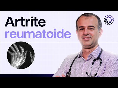 Artrite reumatoide