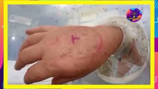 ¡ASI FUNCIONAN LOS REPELENTES DE MOSQUITOS! 🦟