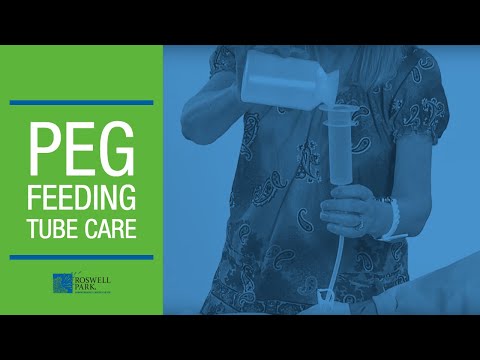 PEG Feeding Tube Care Instructions | Roswell Park Patient Education