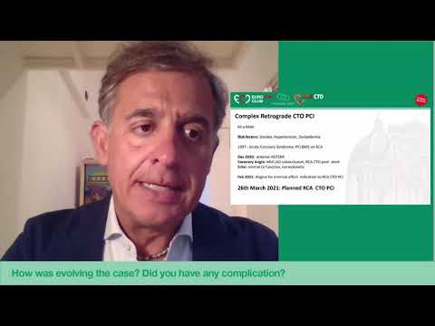 Complex RCA CTO from antegrade to retrograde approach by Dr R. Garbo