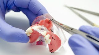 preview picture of video 'dental implants chandler az | We Can Help | (480) 899-6407'