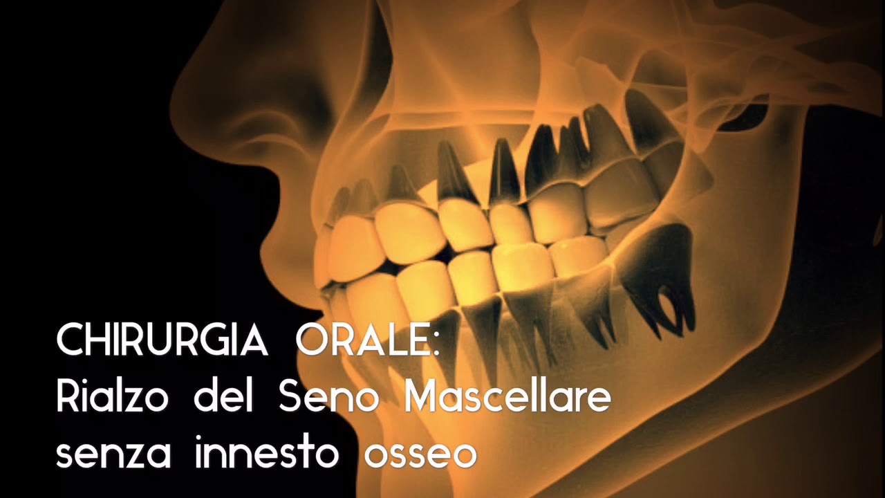 Alessandro Masellis-7