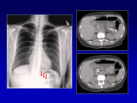 How to Read a Chest Radiograph   FAARDIT