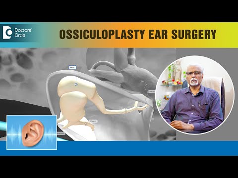 Hearing Loss Treatment - OSSICULOPLASTY Ear Surgery Procedure- Dr.Harihara Murthy | Doctors' Circle