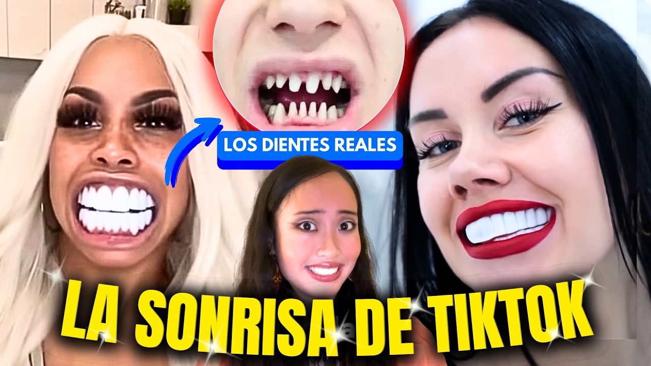 LA SONRISA VIRAL PERFECTA por 1500 dólares...termina en una PESADILLA DENTAL