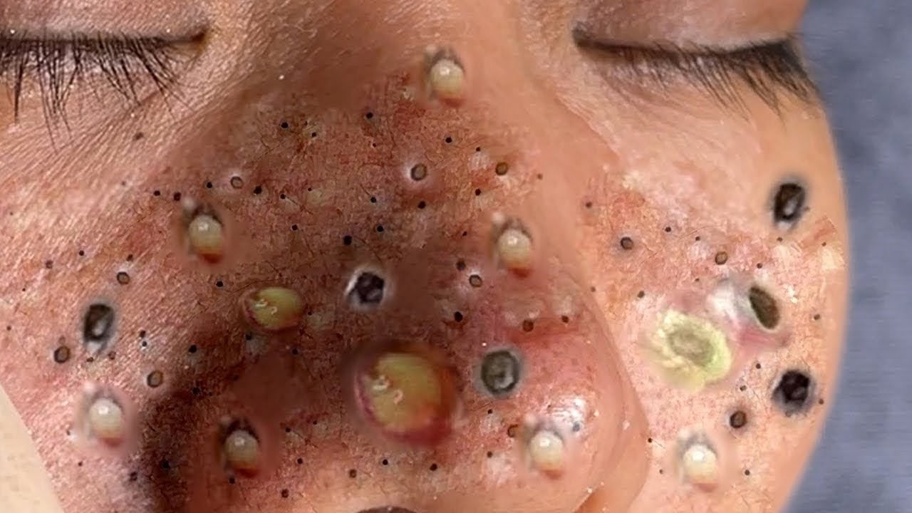 𝑺𝒐𝒐𝒕𝒉𝒊𝒏𝒈 𝑭𝒂𝒄𝒊𝒂𝒍 𝑻𝒓𝒆𝒂𝒕𝒎𝒆𝒏𝒕 𝑭𝒐𝒓 𝑺𝒕𝒓𝒆𝒔𝒔 𝑹𝒆𝒍𝒊𝒆𝒇 𝒂𝒕 𝑳𝒖𝒙𝒖𝒓𝒚 𝑺𝒑𝒂 𝑨𝒄𝒉𝒊𝒆𝒗𝒆 𝑰𝒏𝒏𝒆𝒓 𝑷𝒆𝒂𝒄𝒆 #35235