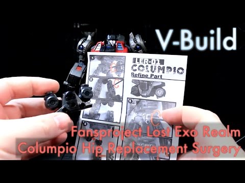 Columpio's Hip Replacement Surgery - V-Build 66