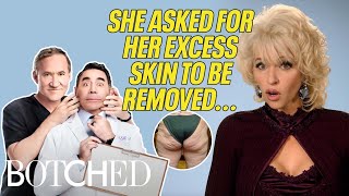 Dolly Parton Impersonator Was Left With Extra Saggy Skin?! (Before &amp; After) | Botched | E!
