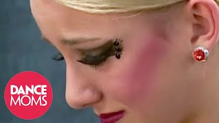 Chloe FALLS &amp; Freaks Out Right Before Performance! Ouch! 😨 | Dance Moms | #Shorts