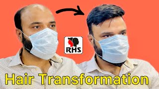 Hair Transformation | Non Surgical Hair Treatment | Hair Patches Center In India | Viral On Youtube